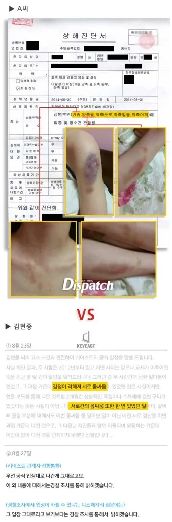 Kim Hyun Joong assault evidence