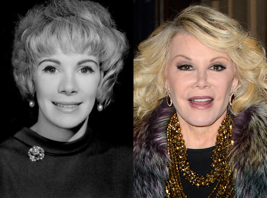 Joan Rivers Before & After