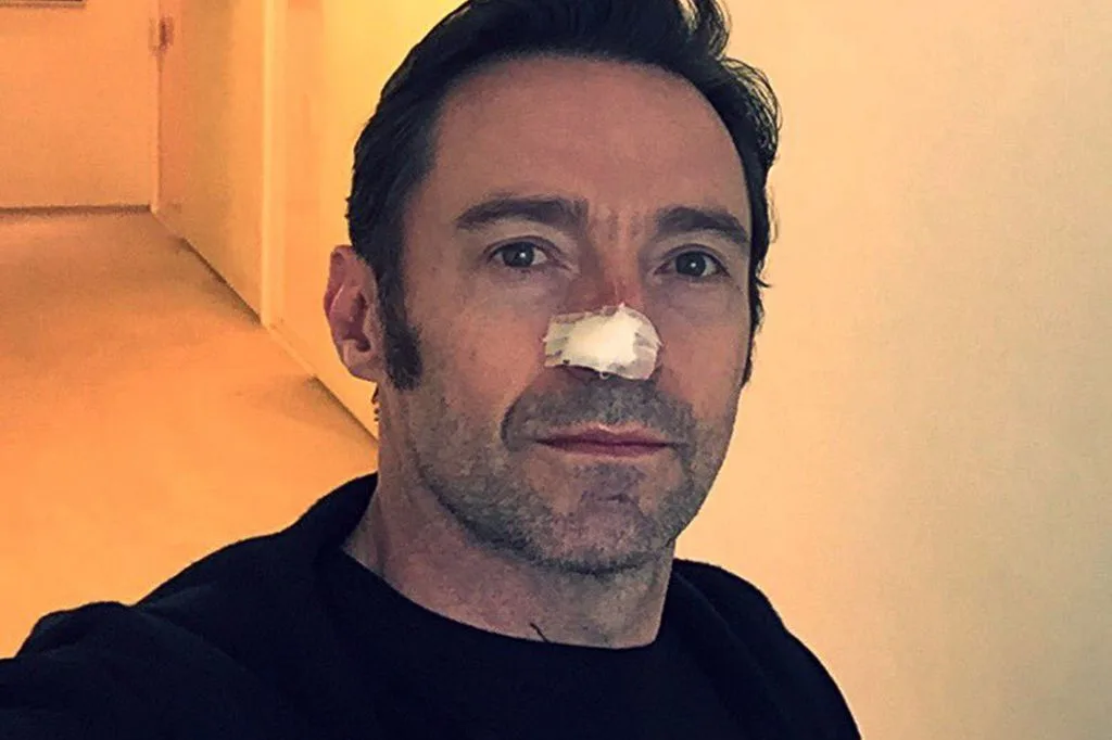 Hugh Jackman carcinoma 