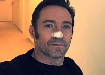 Hugh Jackman carcinoma https://twitter.com/RealHughJackman/status/831243114761297920/photo/1