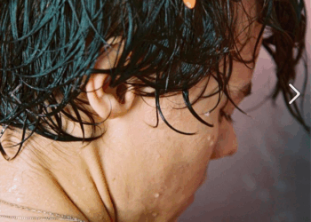 Harry Styles