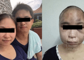 Man Injures Wife