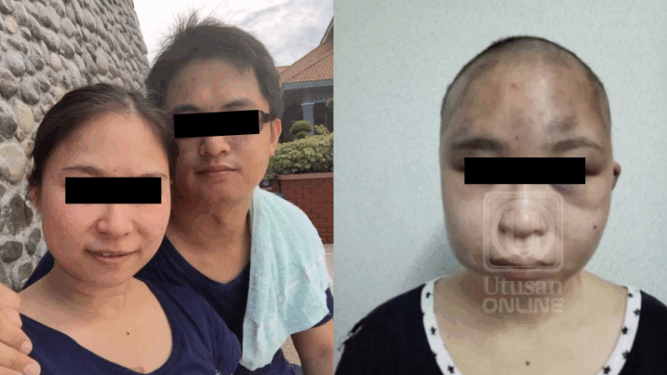 Man Injures Wife