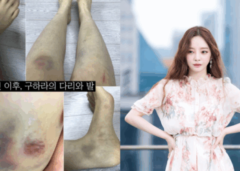 Hara