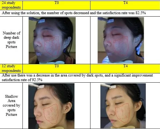 Glutalight Whitening System