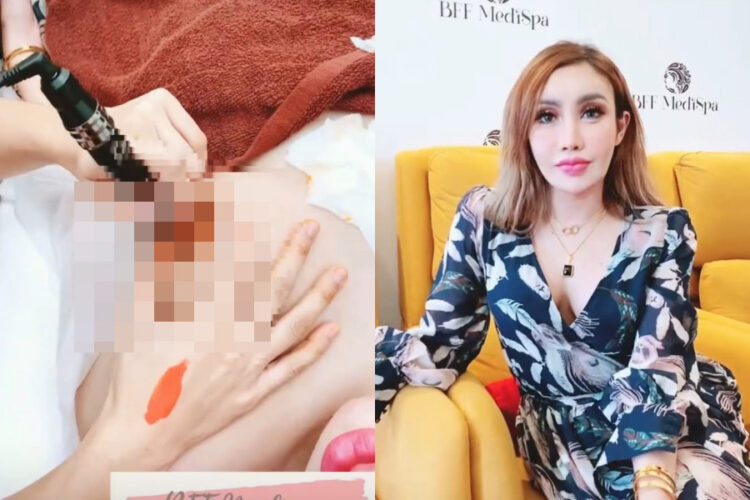 Safiey Ilias Undergoes Cosmetics Surgery On Her Breast & Nipples
