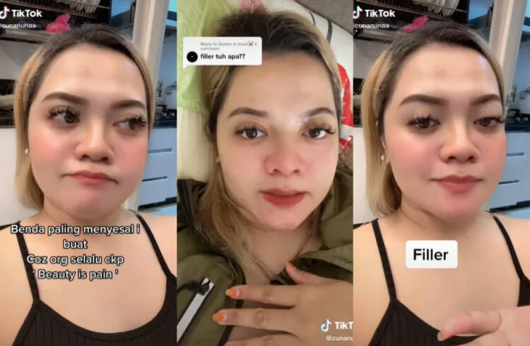 SOURCE: TIKTOK @CUNANUNAA