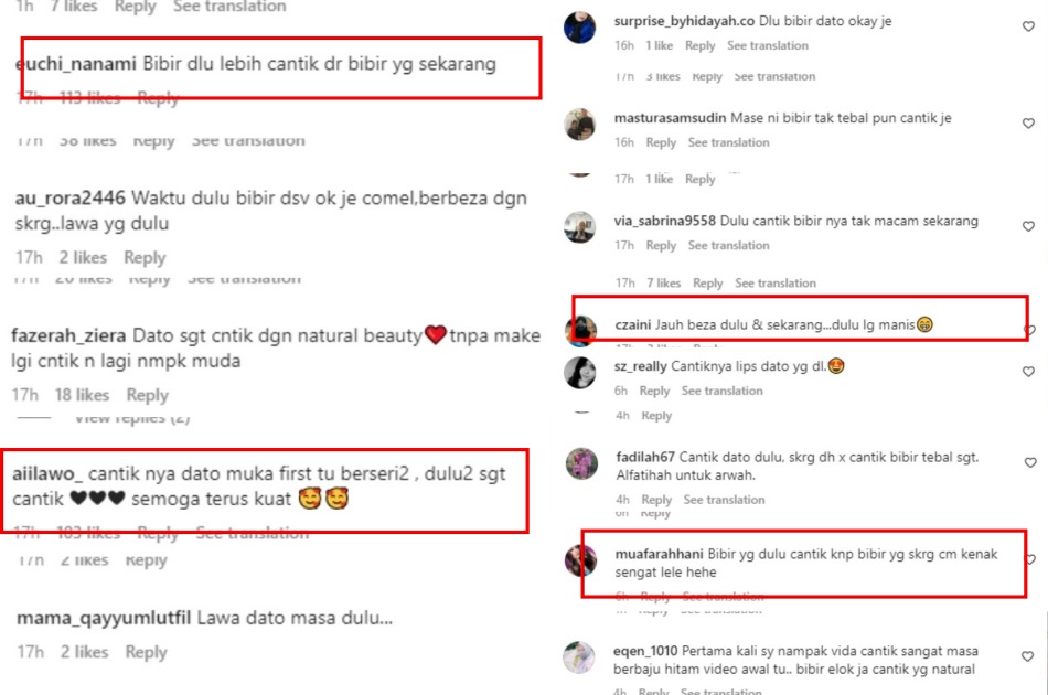 Netizens Feel That Dato Seri Vida Looked Better Before She
