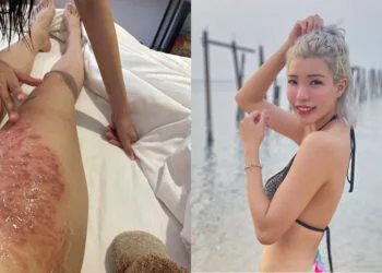 Sources: Facebook/~ leina ~/Instagram/@leinalei