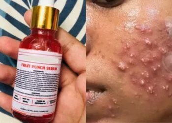 SOURCES: CAROUSELL & TWITTER