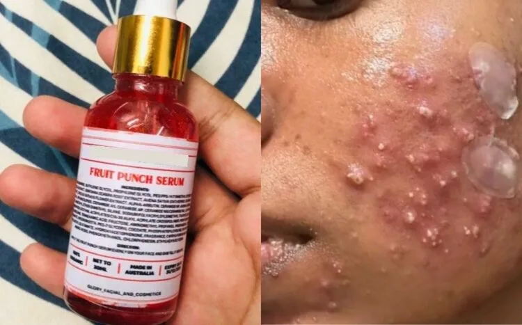 SOURCES: CAROUSELL & TWITTER