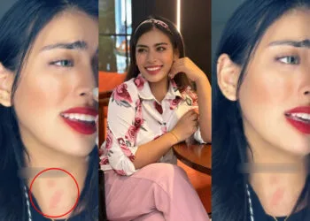 Source: TikTok/IG/yazminaziz