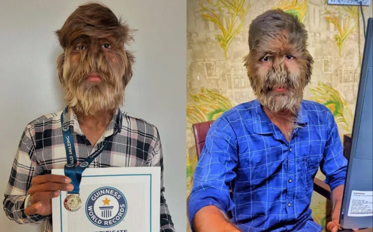 Source: The Guinness World Record, News.com.au