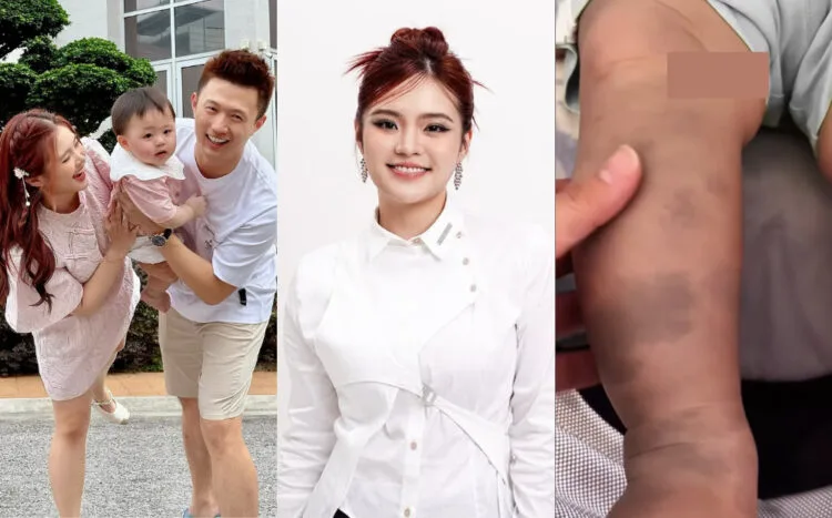 SOURCES: INSTAGRAM (@jeii_pong)