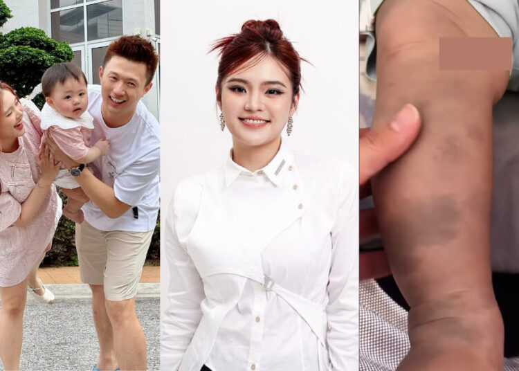 SOURCES: INSTAGRAM (@jeii_pong)