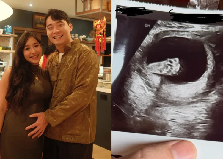 SOURCES: INSTAGRAM (@mrnigelng)